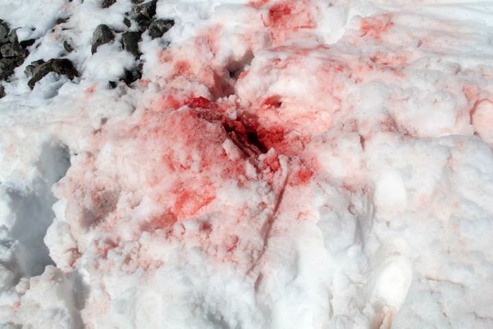 <strong>Schwere Schädelverletzung nach Sturz mit starker Blutung </strong><span class=>© Felix Autor<br /></span>