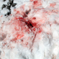 <strong>Schwere Schädelverletzung nach Sturz mit starker Blutung </strong><span class=>© Felix Autor<br /></span>