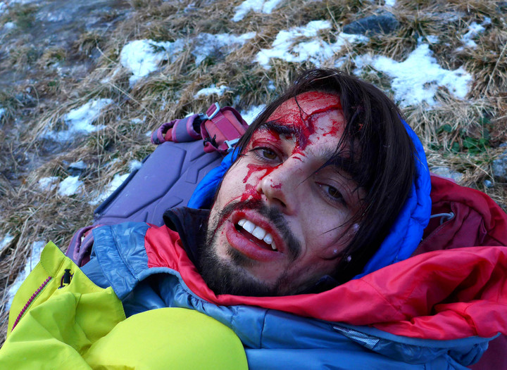 <strong>Platzwunde nach Absturz im vereisten Gelände</strong> <span class=>© Esther Baum<br /></span>