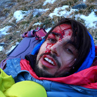 <strong>Platzwunde nach Absturz im vereisten Gelände</strong> <span class=>© Esther Baum<br /></span>